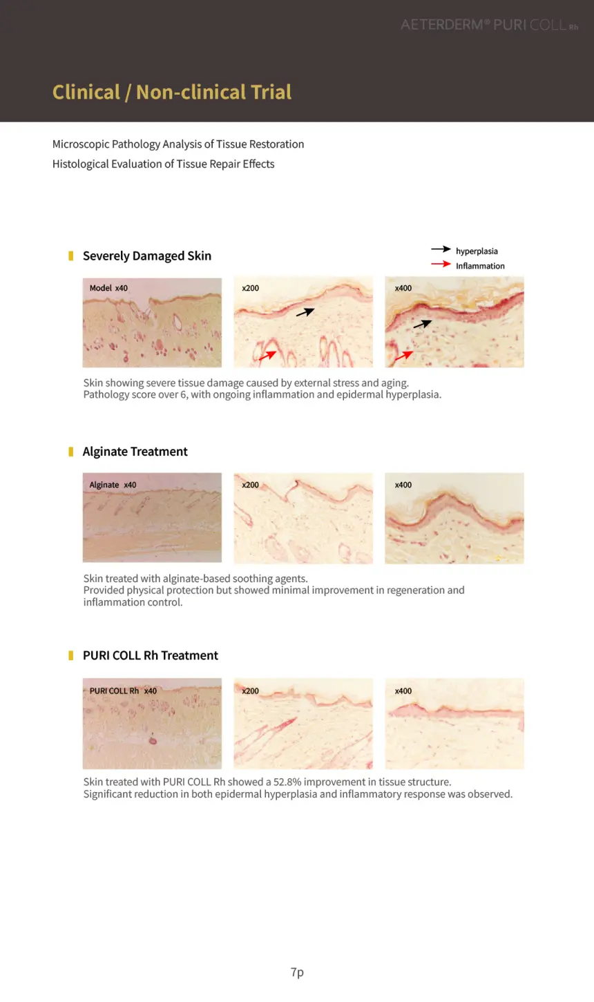 PURI COLL Rh brochure page 7