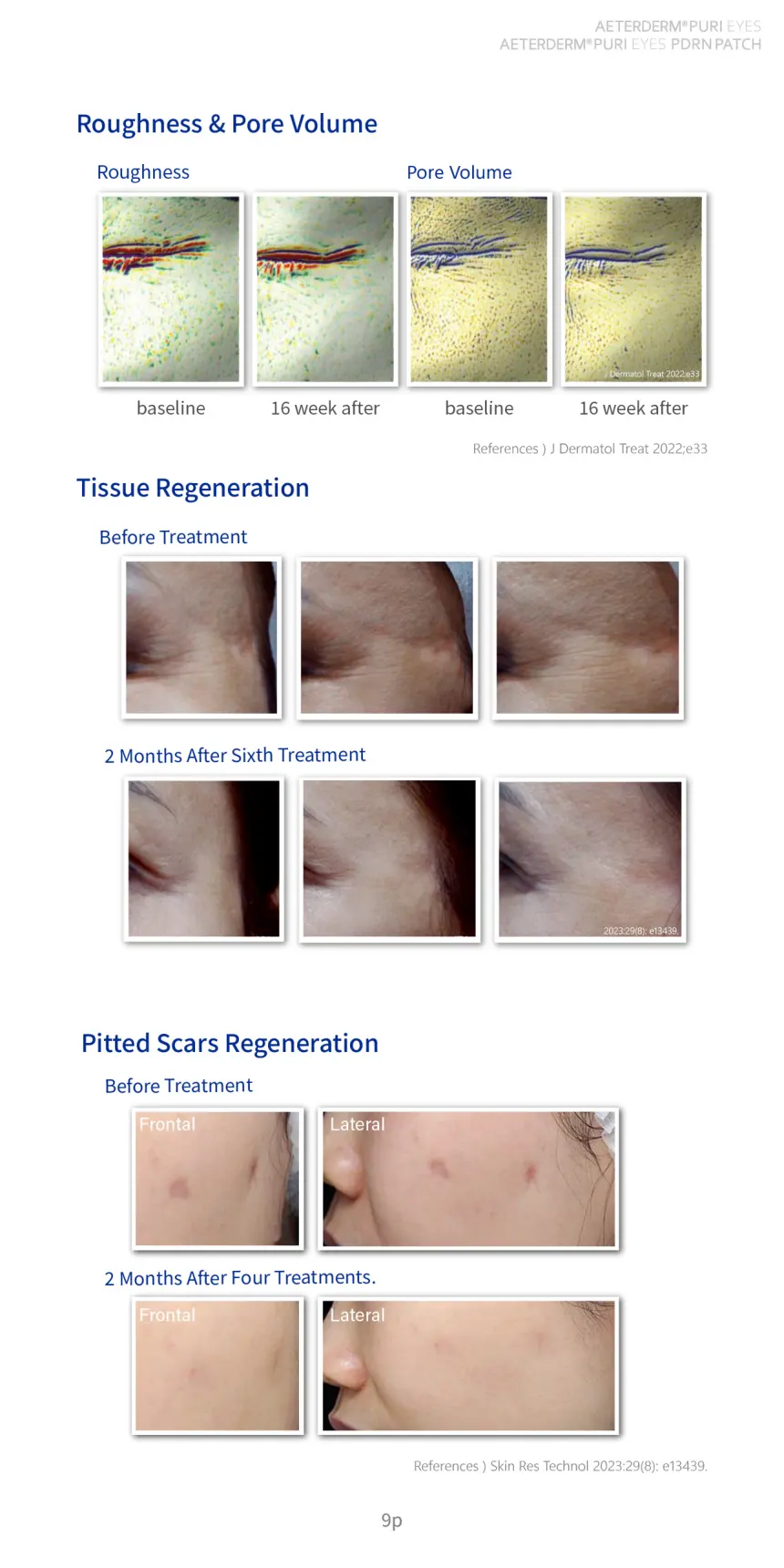 PURI EYES & Pro brochure page 9