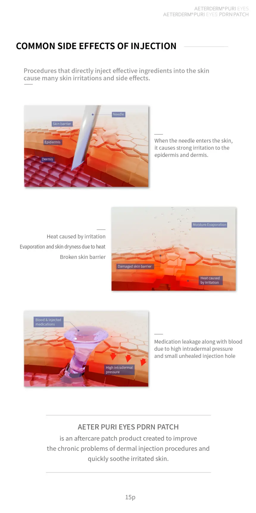 PURI EYES & Pro brochure page 15