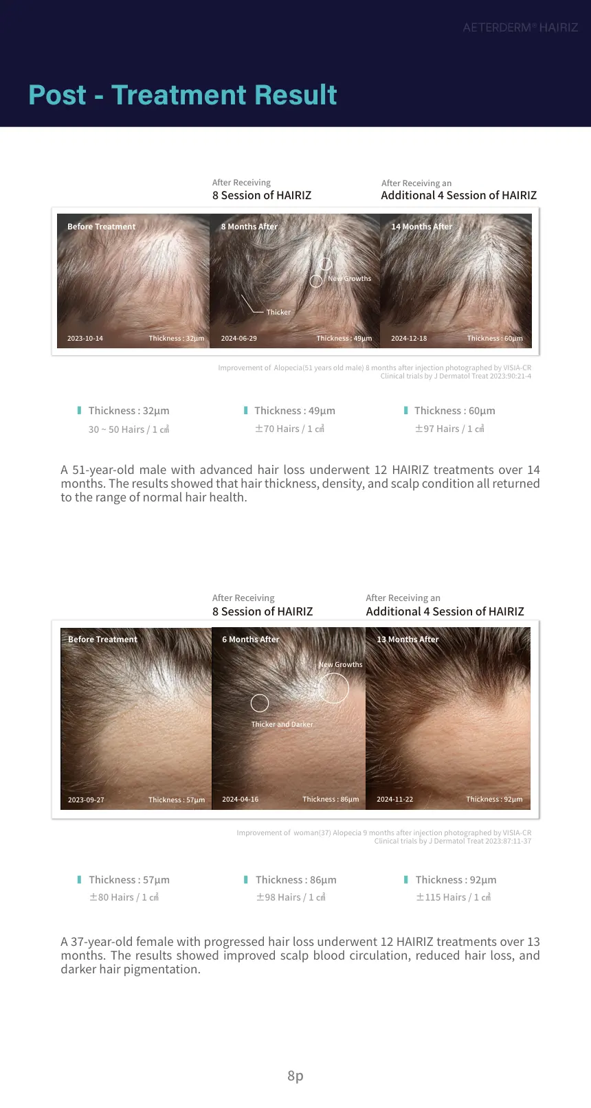 HAIRIZ 3D Exo Hair Scalp Care Filler brochure page 8