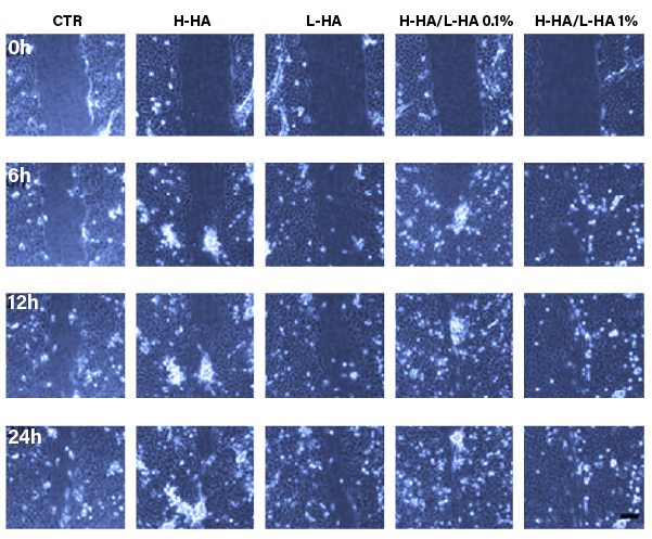 tissue repair clinical trial sheet images