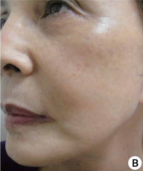 clinical trial A after image