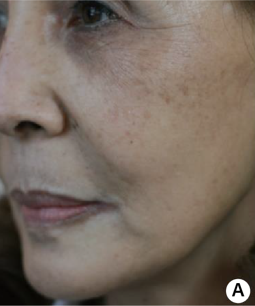clinical trial A before image