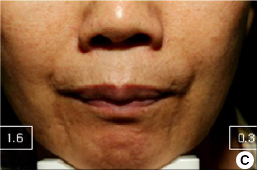 clinical trial B after 12 weeks image