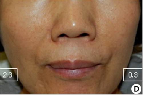clinical trial B after 24 weeks image