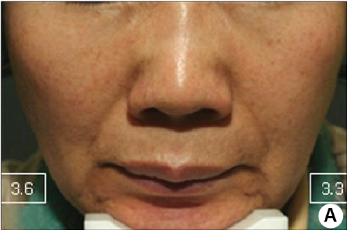 clinical trial B baseline image