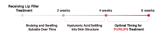 from Receving Lip Filler Treatment to 2 weeks period, Bruising and swelling subside over time. from 2 to 4 weeks period, Hyaluronic Acid Settling into Skin Structure. from 4 to 6 weeks period, the optimal timing for PURILIPS treatment.